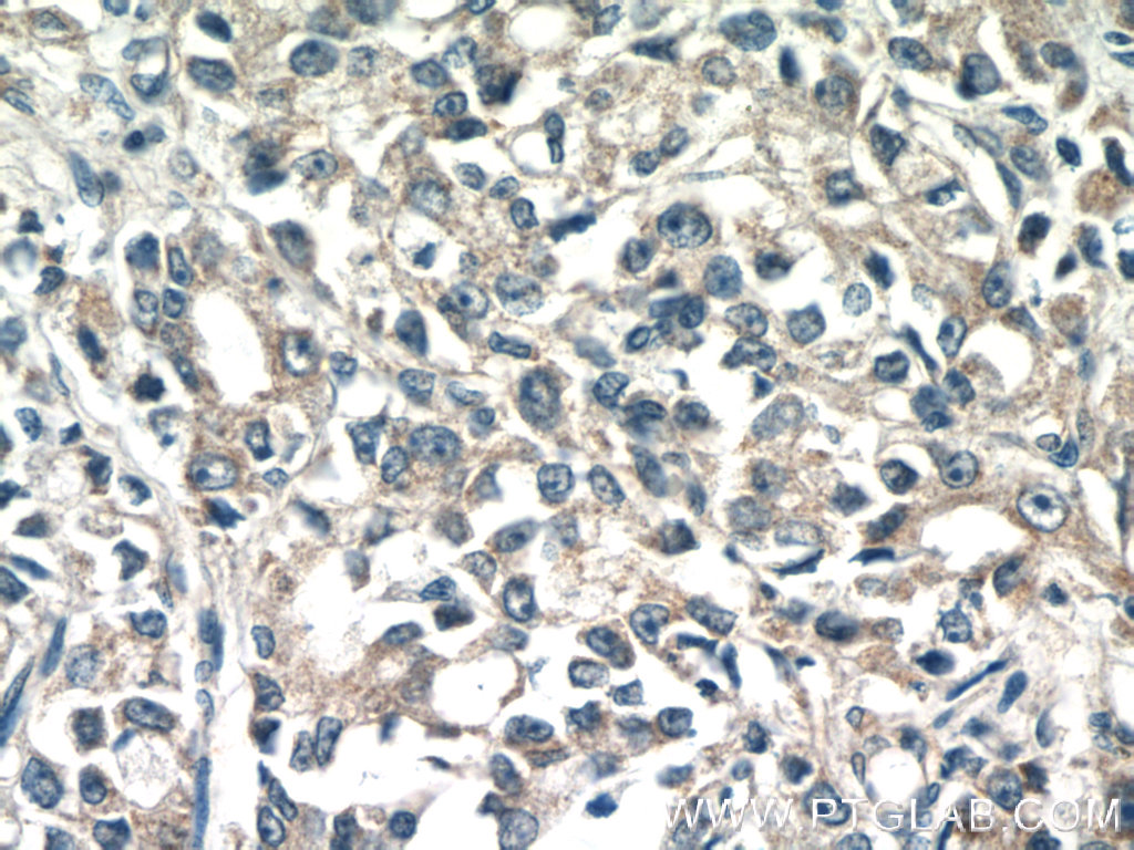 TMEM71 Polyclonal antibody