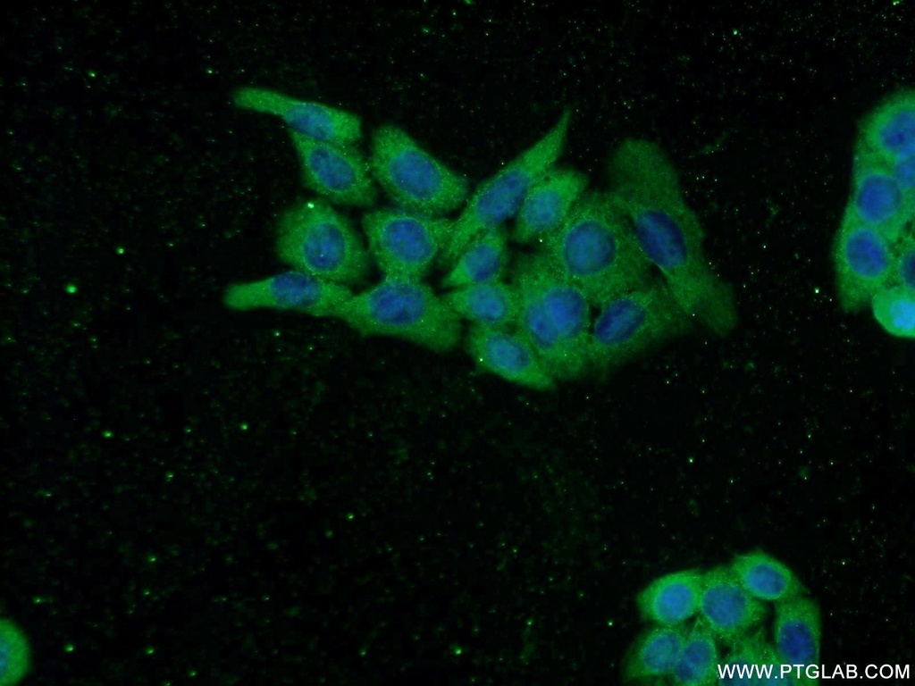 TASP1 Polyclonal antibody