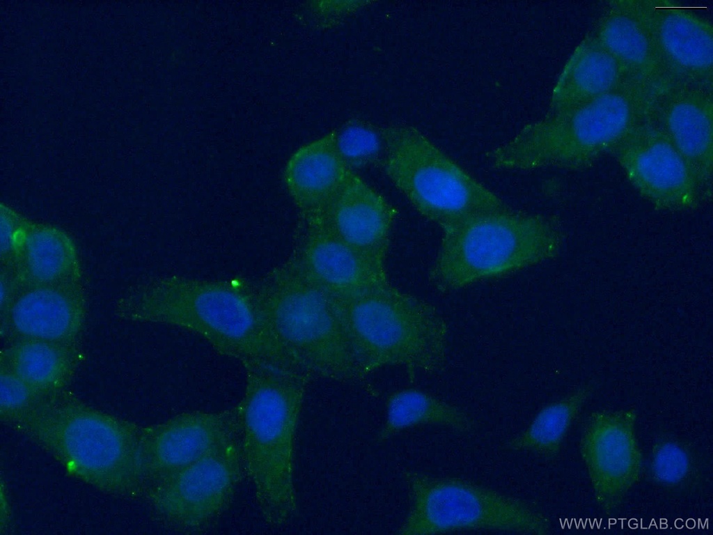 RPL15 Polyclonal antibody