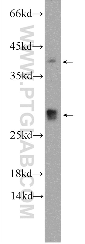 CENPN Polyclonal antibody