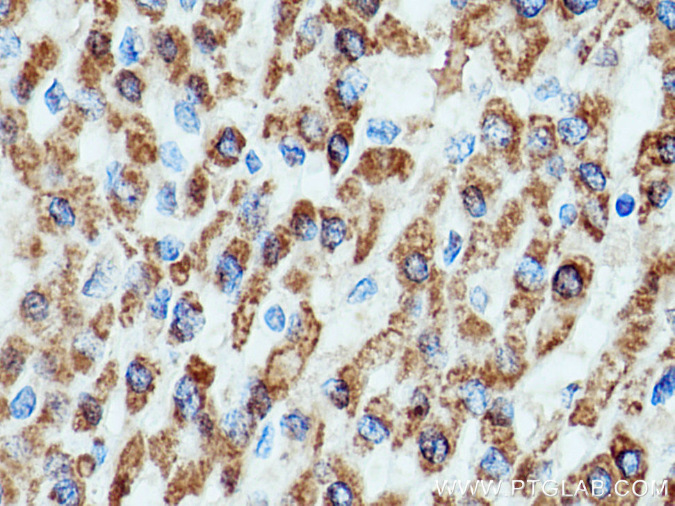 HSD17B8 Polyclonal antibody