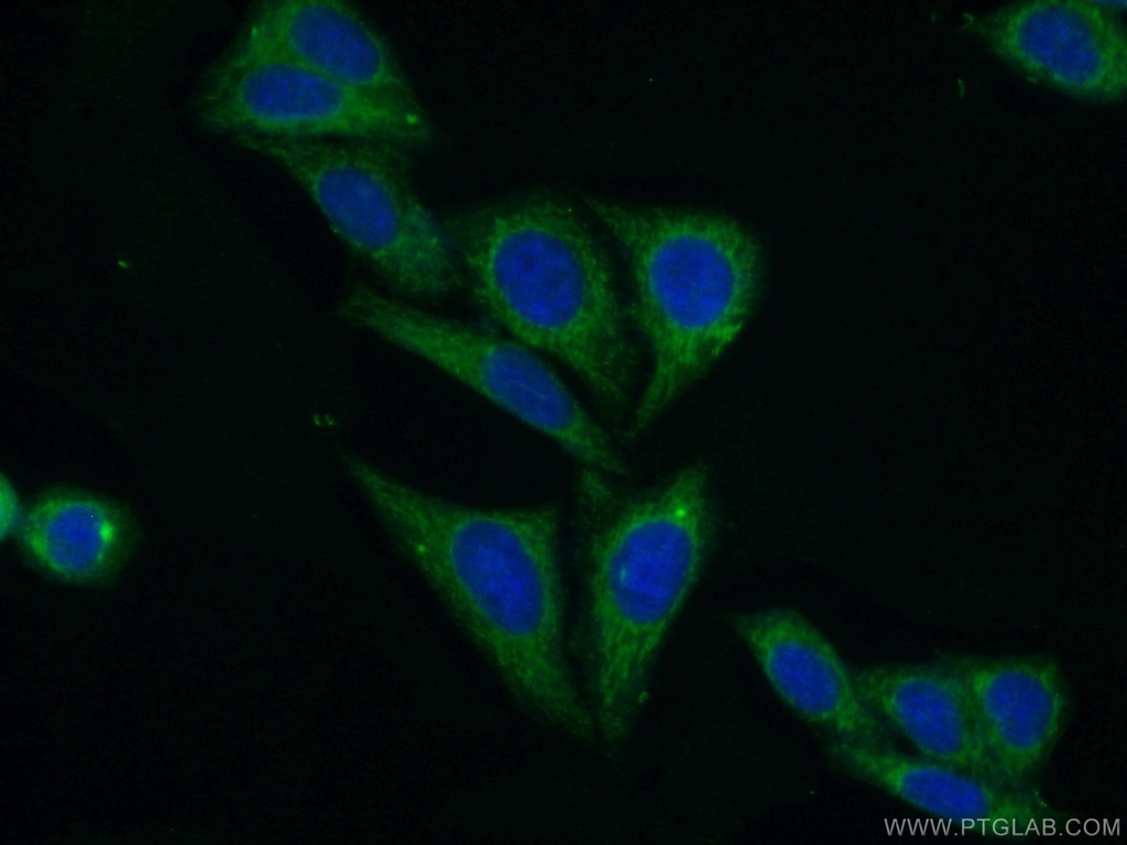 PCK1 Polyclonal antibody