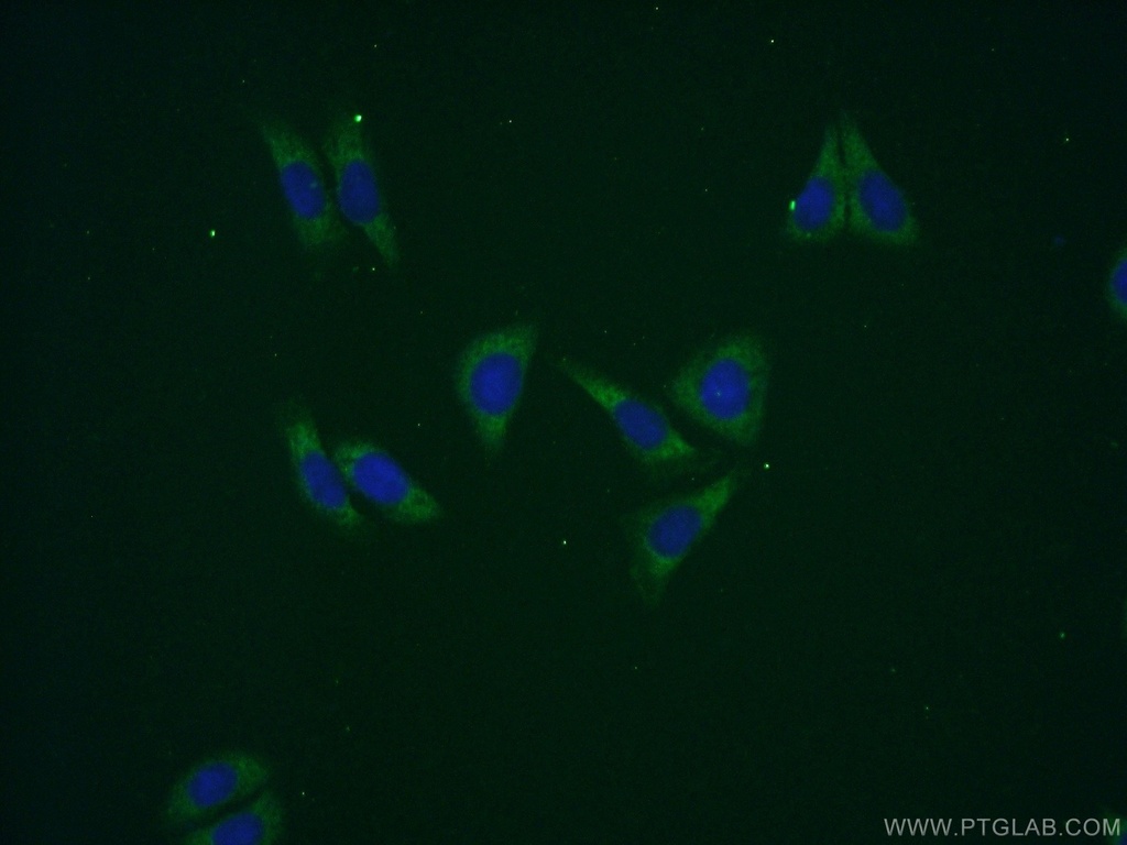 GPT2 Polyclonal antibody