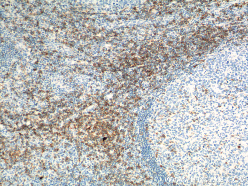 CD6 Polyclonal antibody