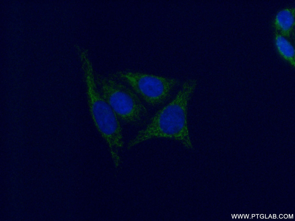 GSTM4 Polyclonal antibody