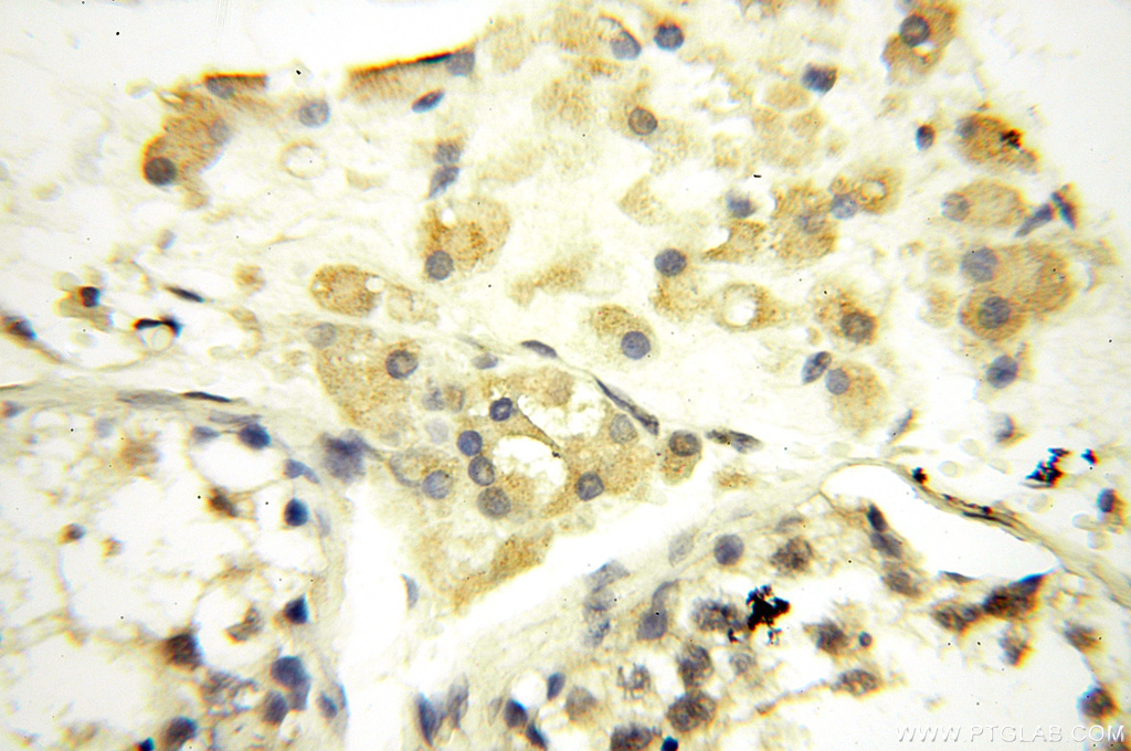 SPAG11A Polyclonal antibody