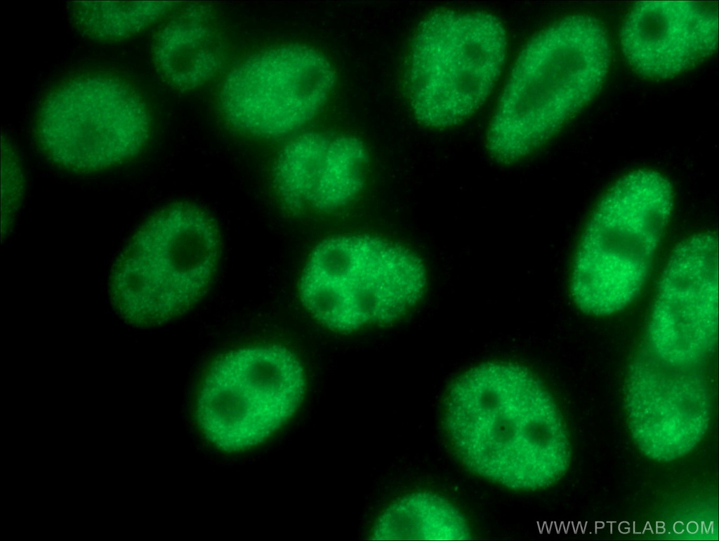 FOXP4 Polyclonal antibody