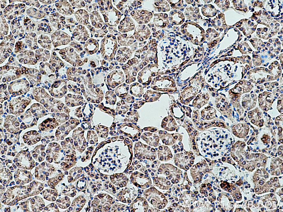 RPLP2 Polyclonal antibody