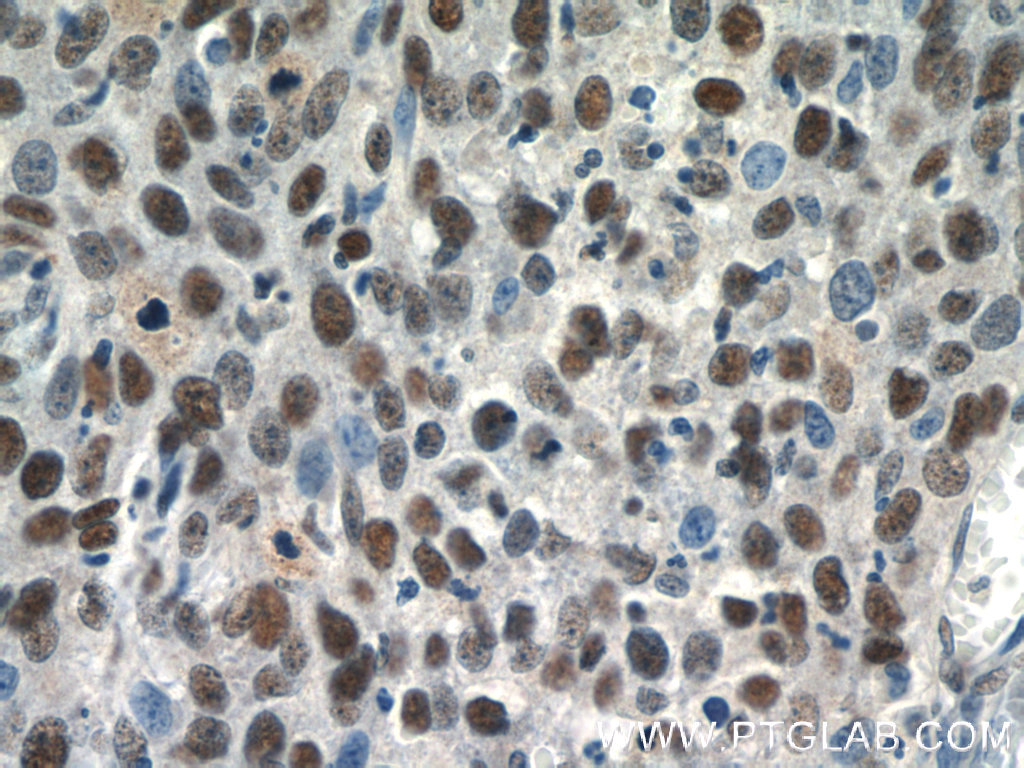 SNRPB Polyclonal antibody