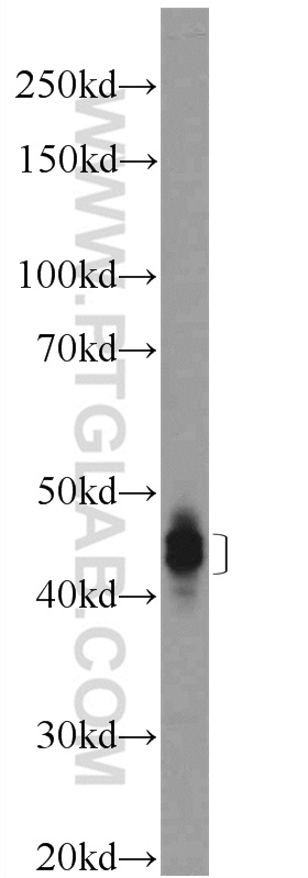 Dematin Polyclonal antibody