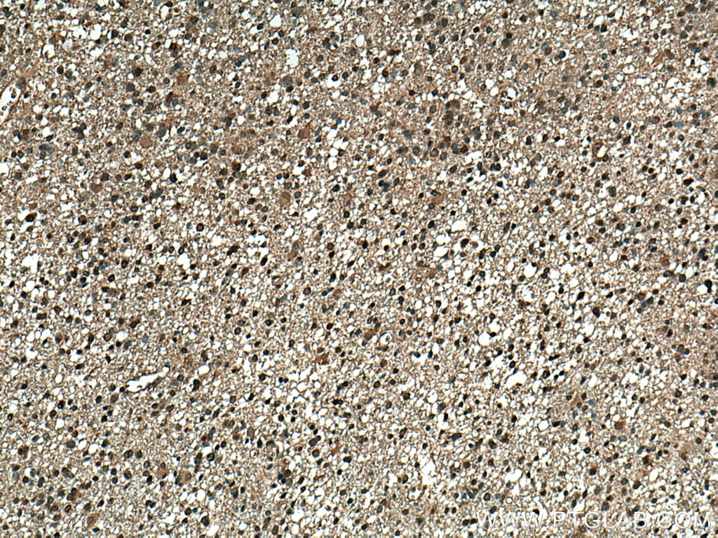 MAGED4 Polyclonal antibody