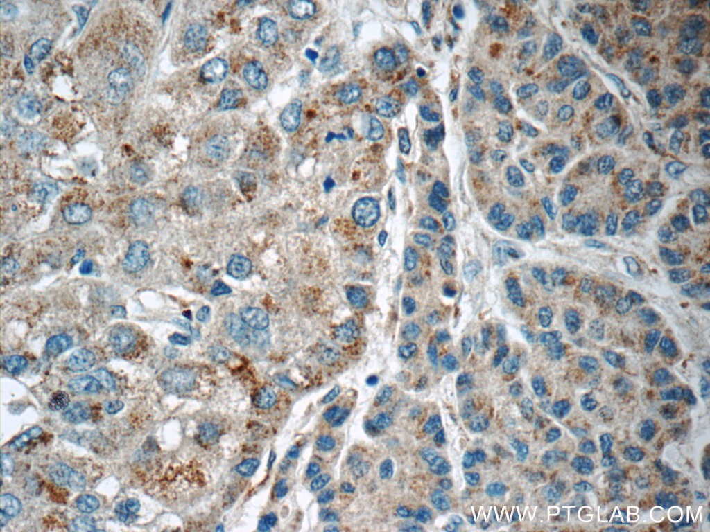 LMF1 Polyclonal antibody