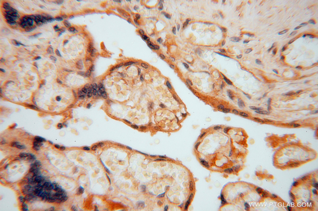 HIP1R Polyclonal antibody