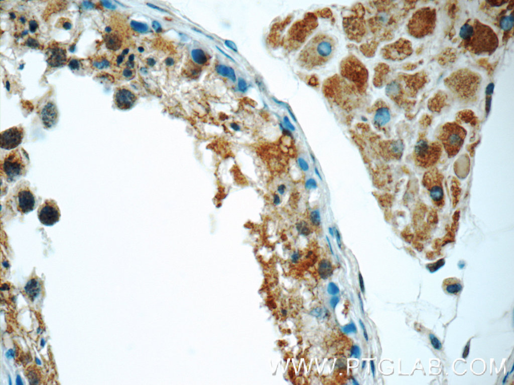 ZC3HAV1 Polyclonal antibody