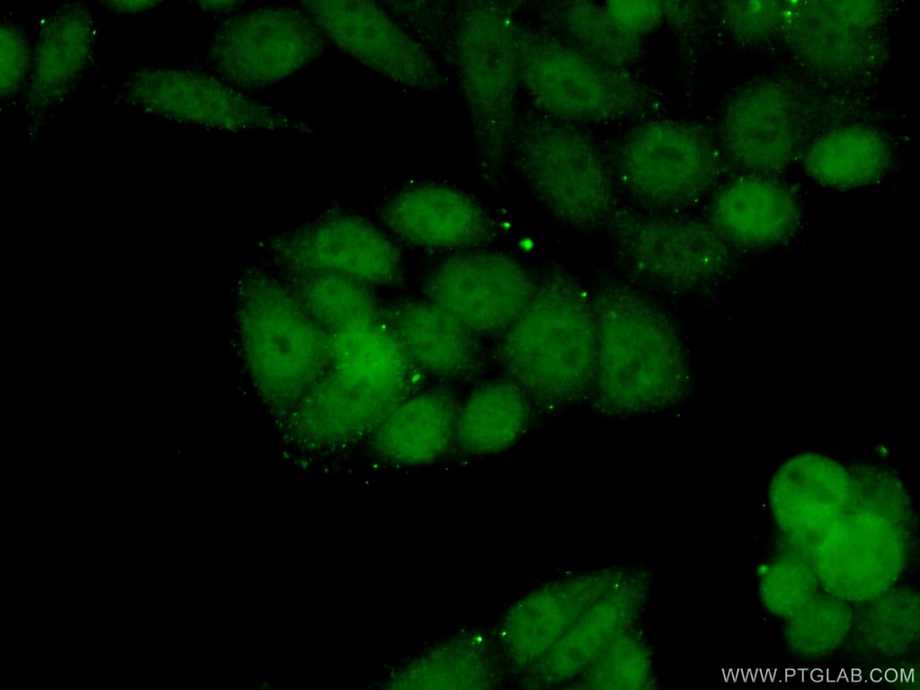 SRF Polyclonal antibody