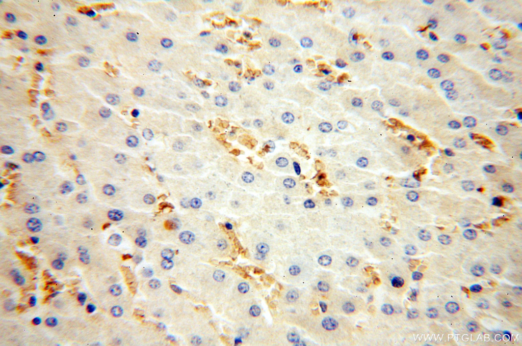 HBD Polyclonal antibody