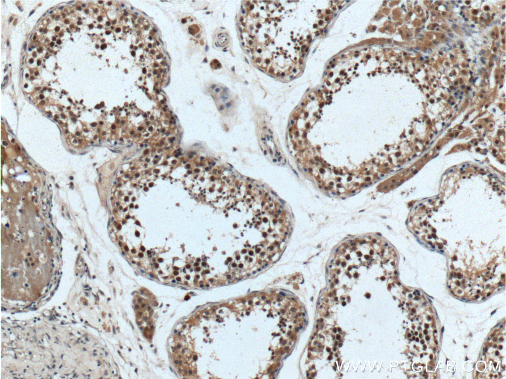 ALKBH5 Polyclonal antibody