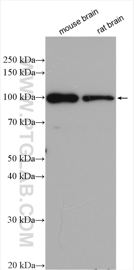JAKMIP2 Polyclonal antibody