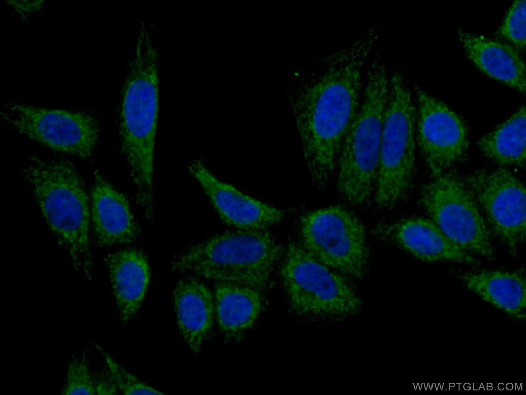 Apolipoprotein A II Polyclonal antibody