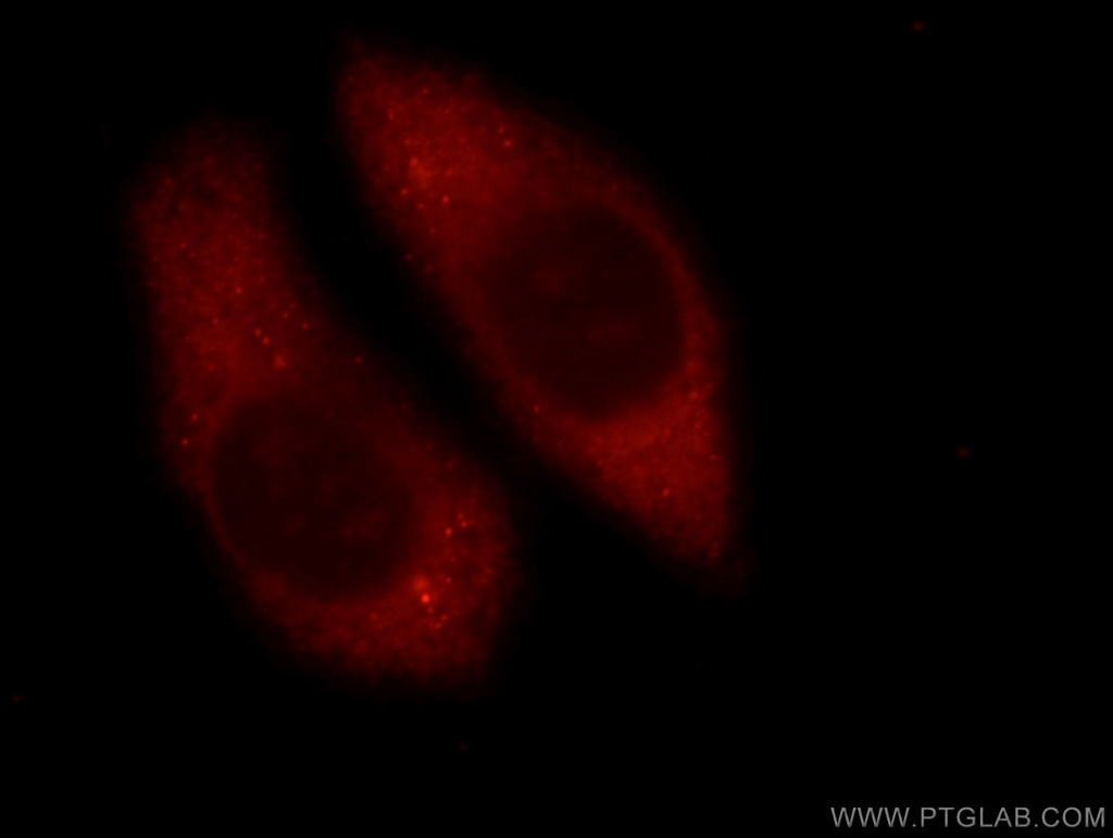 RAB3C-specific Polyclonal antibody