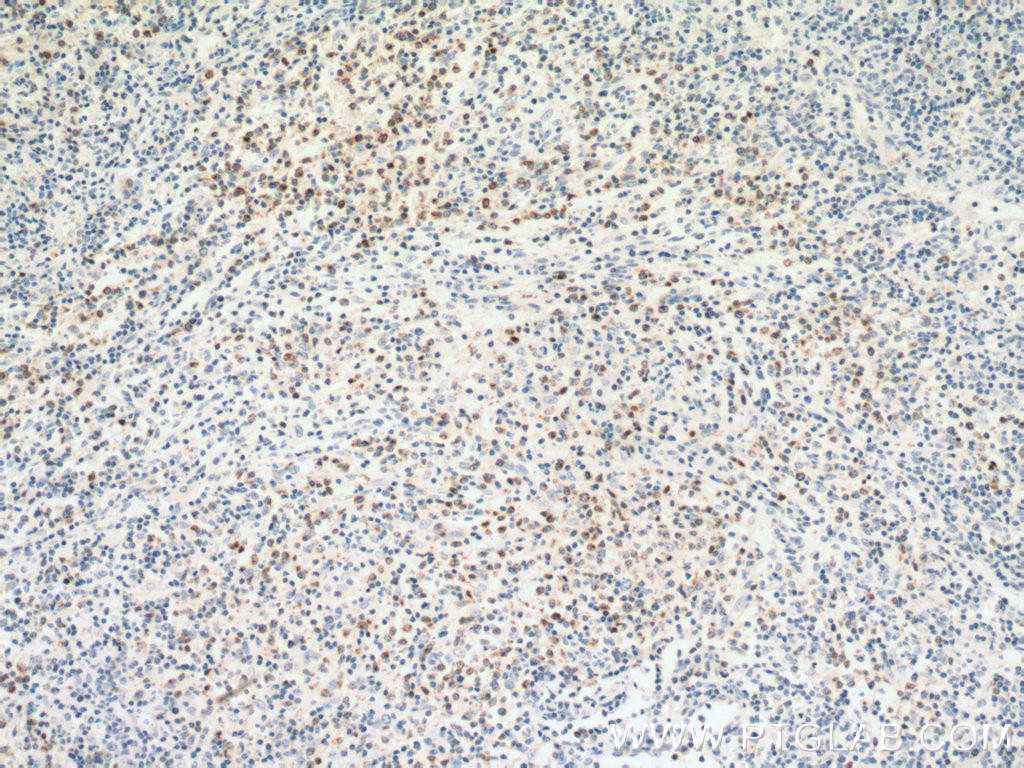 RAB27A-specific Polyclonal antibody