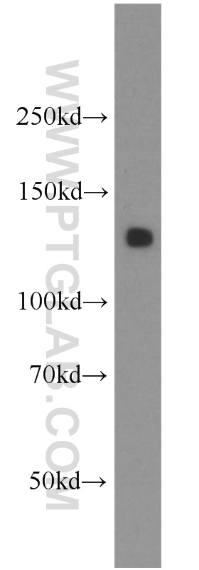 AMOT Polyclonal antibody