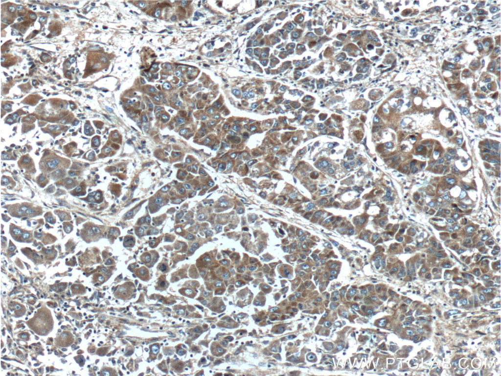 FGF3-Specific Polyclonal antibody
