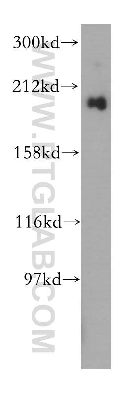 gp210 Polyclonal antibody