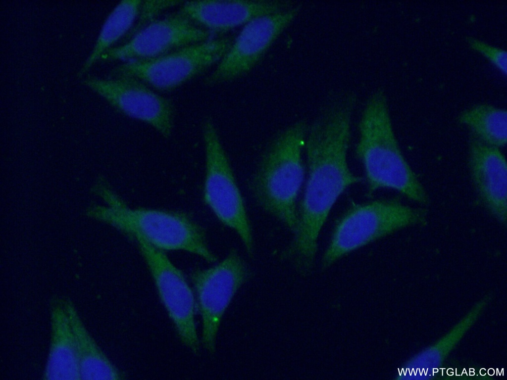 CES1 Polyclonal antibody