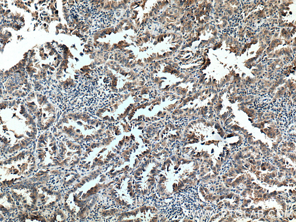 FAM156A Polyclonal antibody