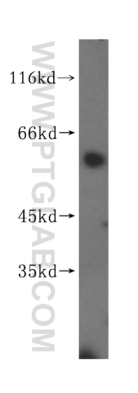KLHDC4 Polyclonal antibody