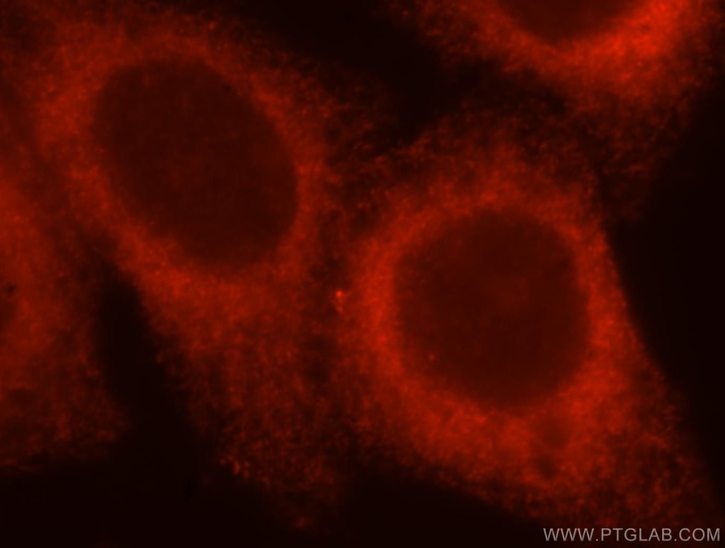 ATL3 Polyclonal antibody