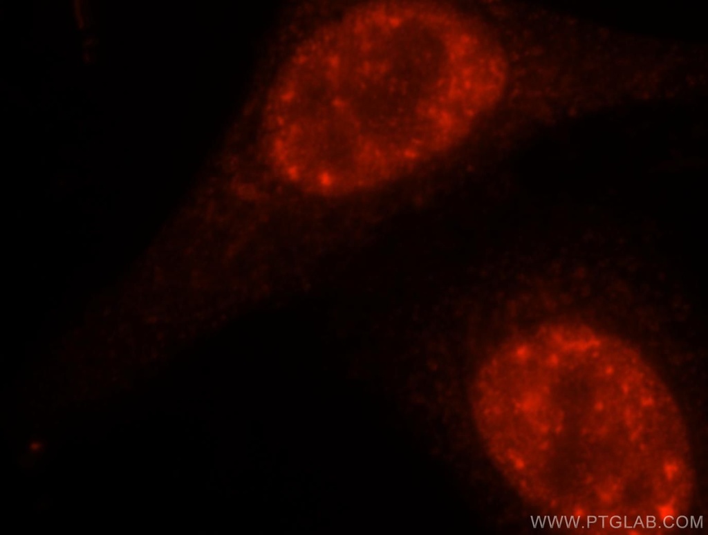 DDX46 Polyclonal antibody