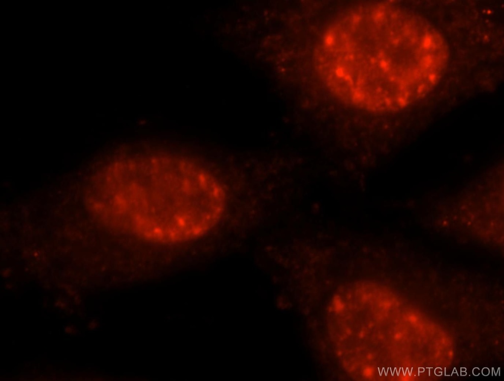 PRPF40B Polyclonal antibody