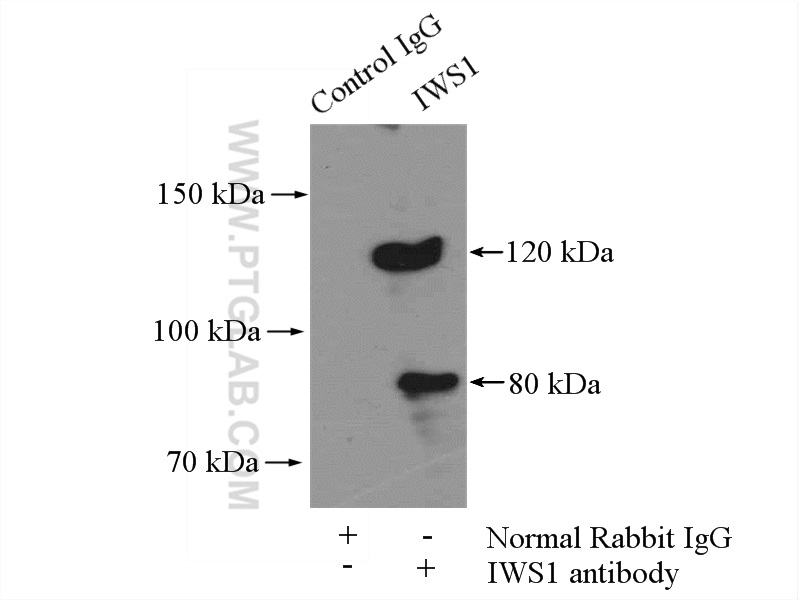 IWS1 Polyclonal antibody