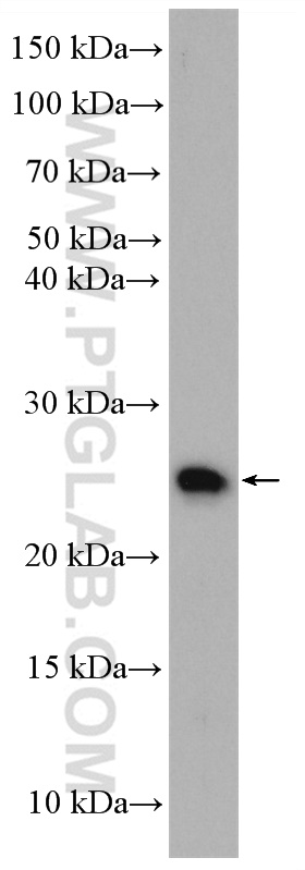 N6AMT2 Polyclonal antibody