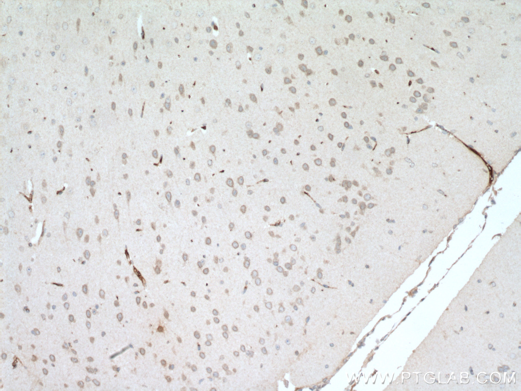 ARL6IP6 Polyclonal antibody