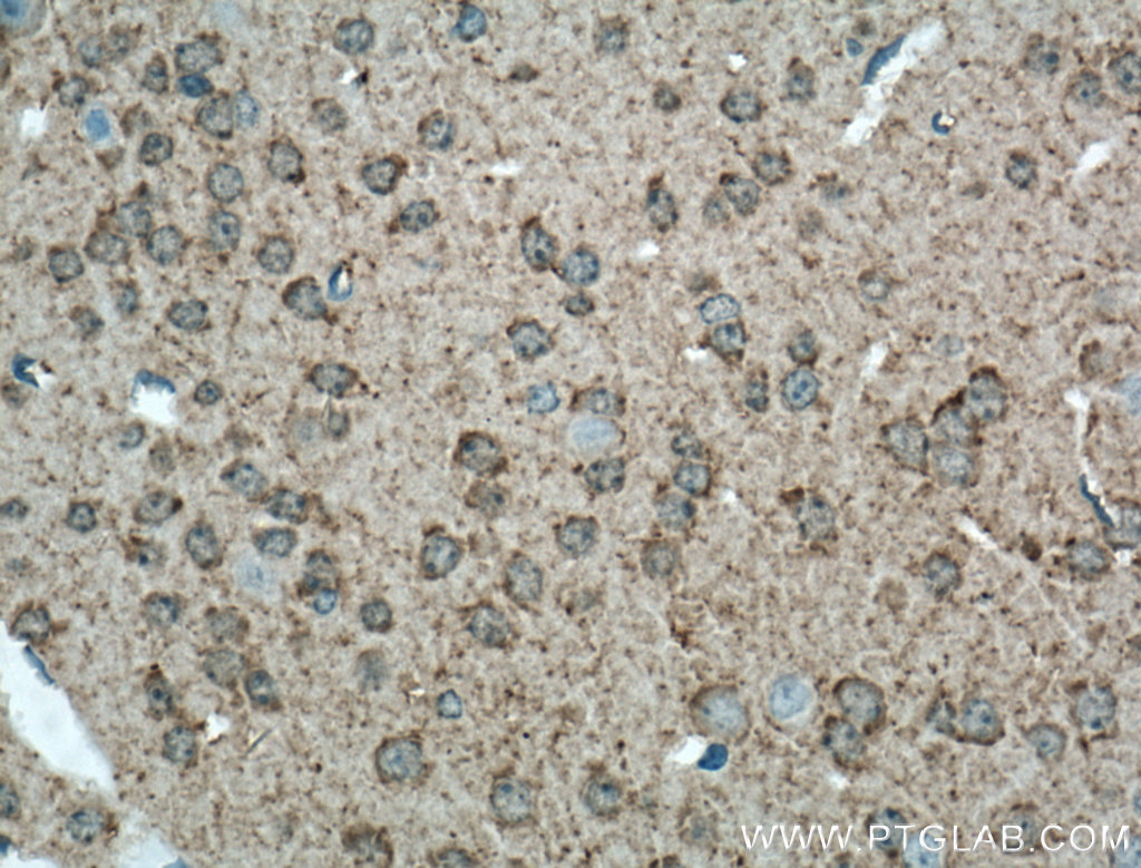 GAP43 Polyclonal antibody