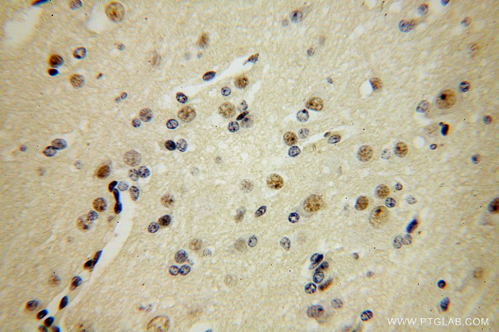 FANCC Polyclonal antibody