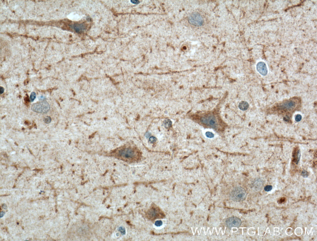 LRRTM4 Polyclonal antibody