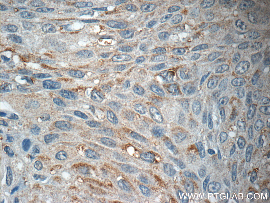 AGBL3 Polyclonal antibody