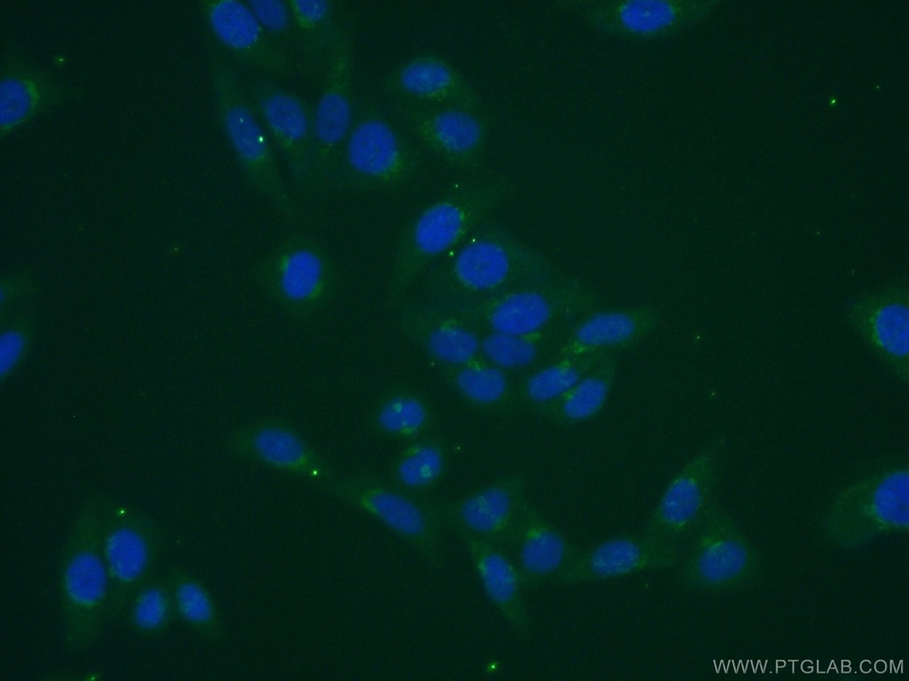 MGAT5B Polyclonal antibody