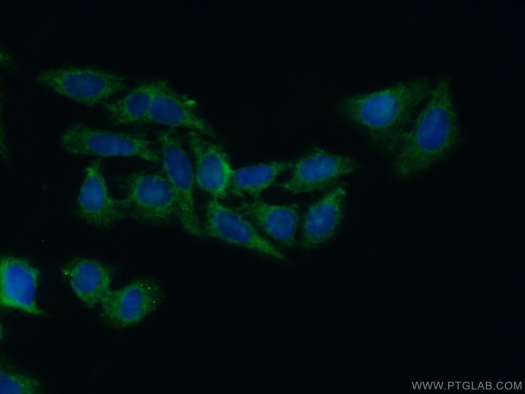 HPD Polyclonal antibody