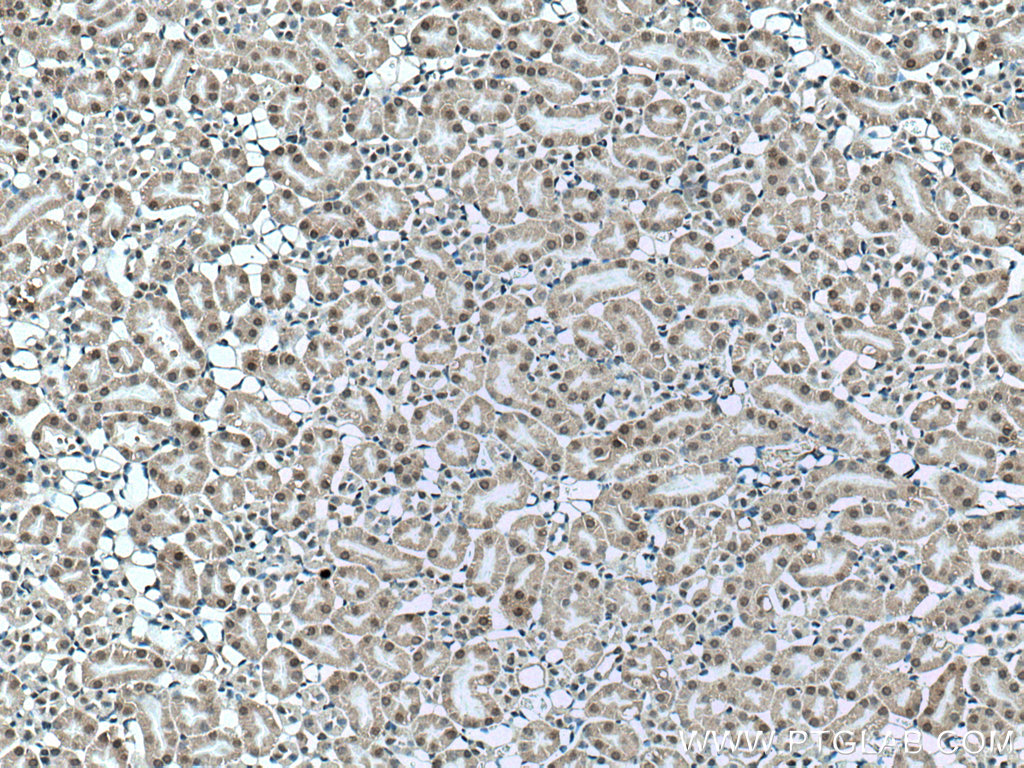UCKL1 Polyclonal antibody