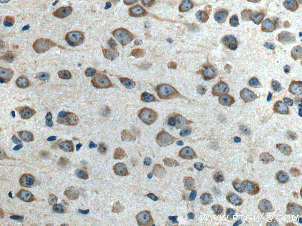 ELP3 Polyclonal antibody