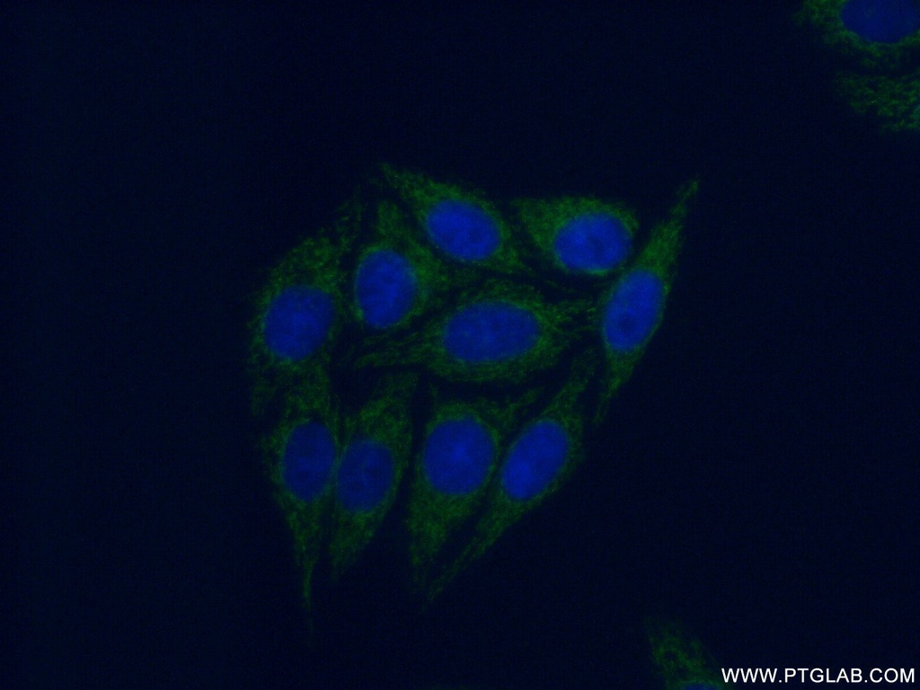 PPM1F Polyclonal antibody