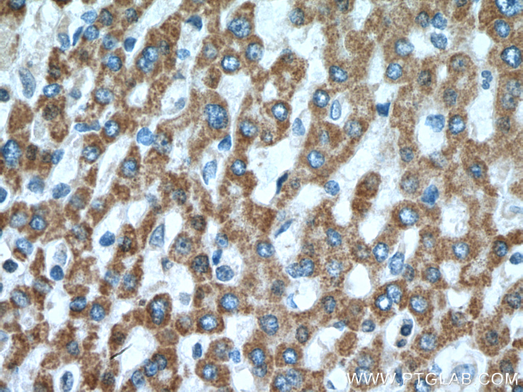 MUT Polyclonal antibody