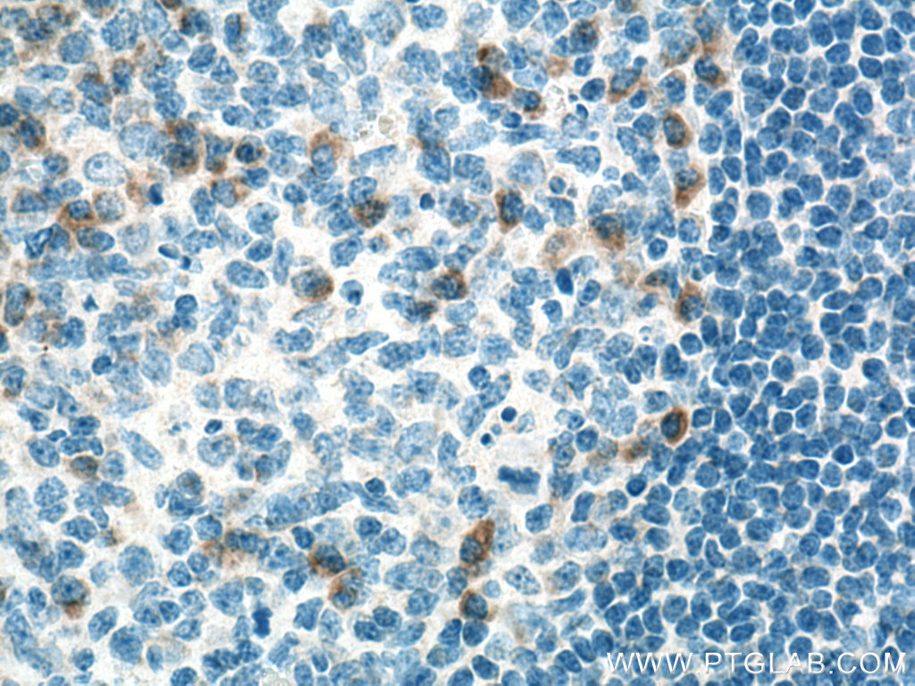 CXCL8/IL-8 Polyclonal antibody