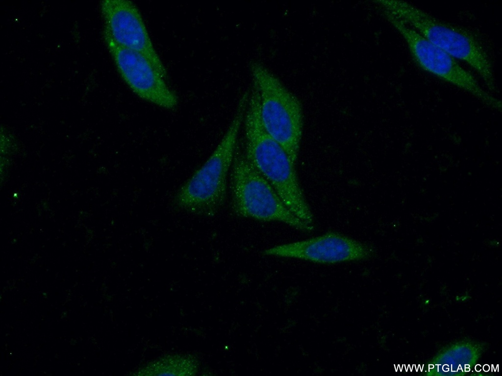 METAP2 Polyclonal antibody