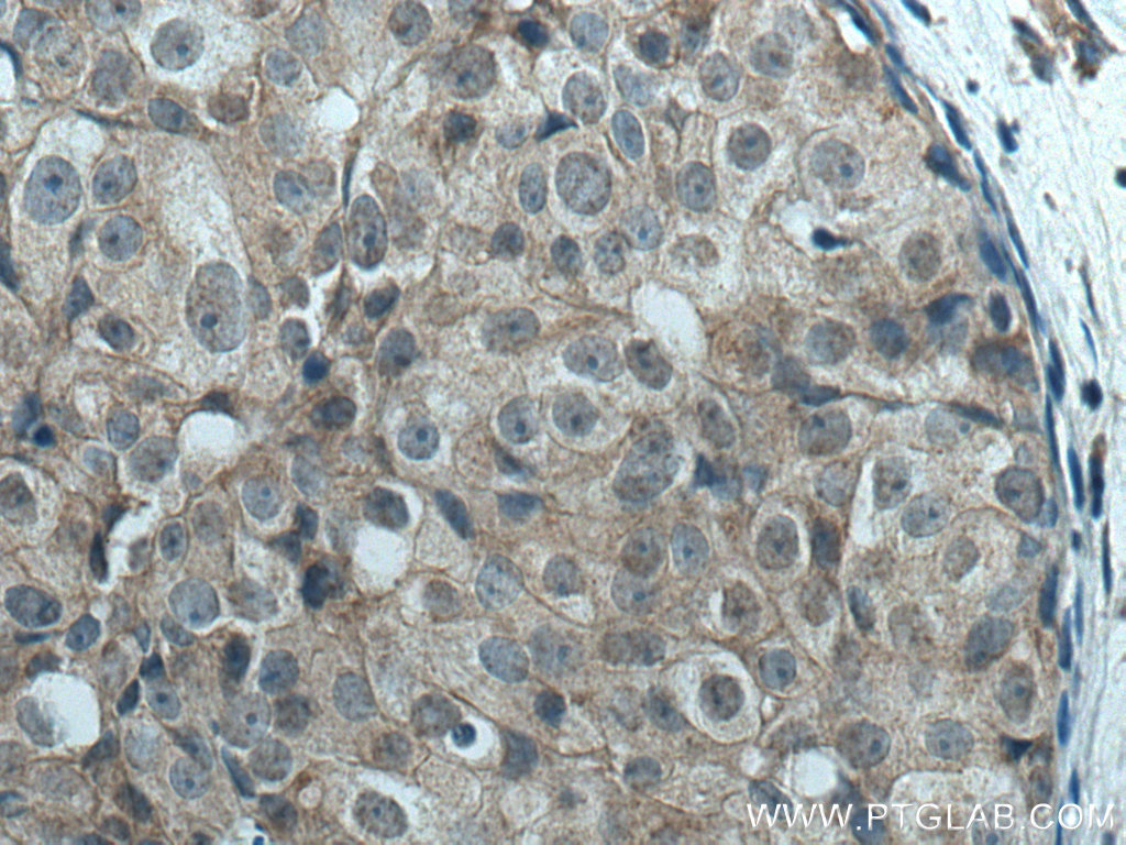 LATS1 Polyclonal antibody